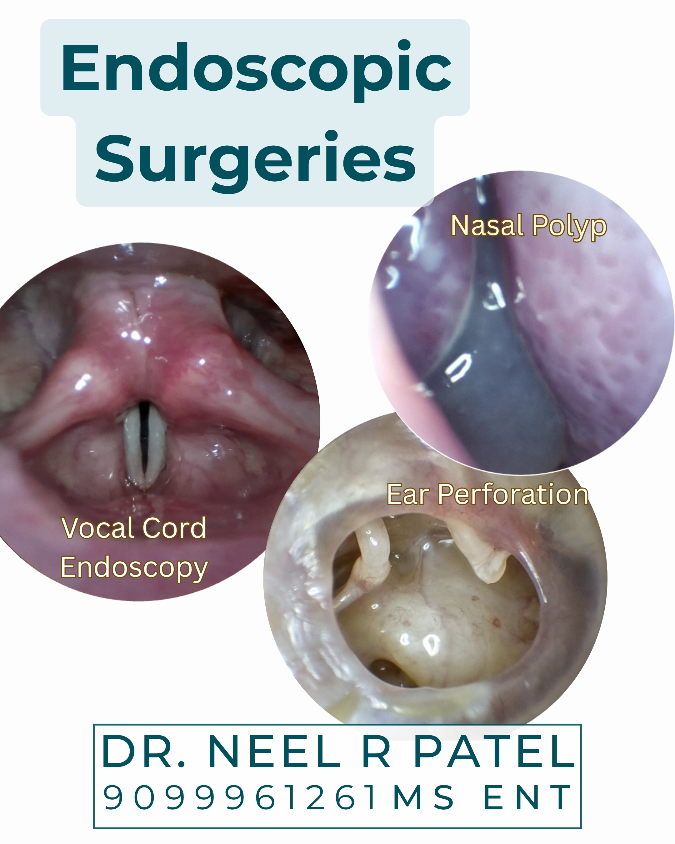 Minimally Invasive ENT Surgery: Benefits and Costs Explained
